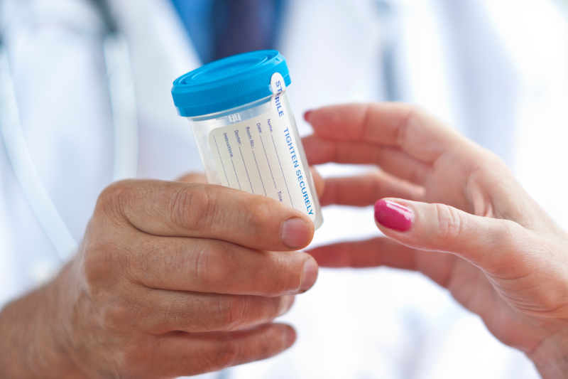 urine drug testing services